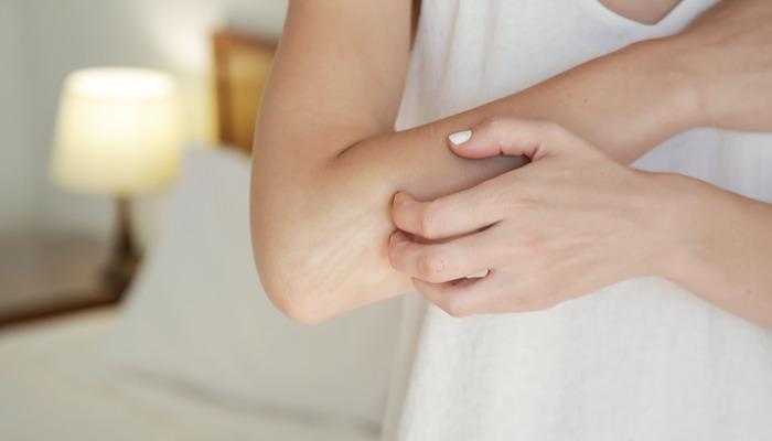 Vücut kaşıntısı neden olur, ne iyi gelir? Kaşıntıyı en çabuk ne geçirir?