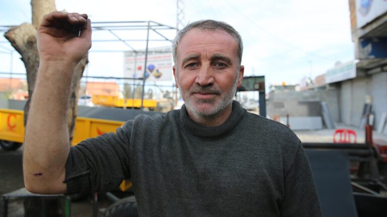 Diyarbakır’da 8 kişi köpeklerin saldırısına uğradı