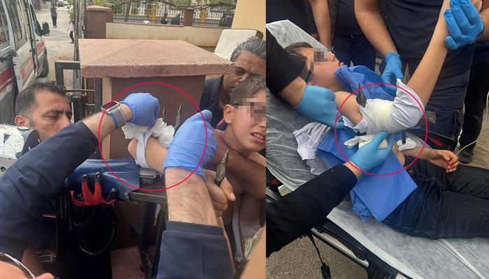 Adana'da korkunç bir olay! Dengesini kaybettiğinde, çit demir koluna girdi … bu şekilde hastaneye kaldırıldı