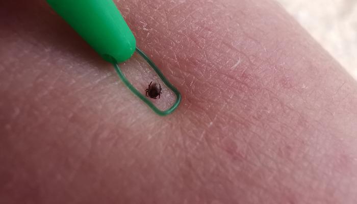 6 Hayat: “Kırım Kongo Yangın Kanaması” Sağlık Bakanlığı Bildirgesi!