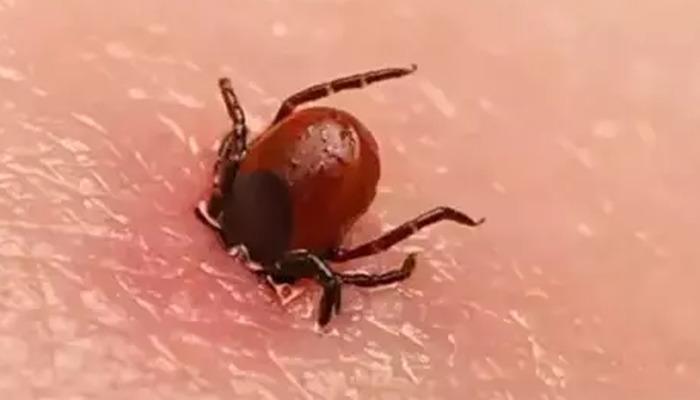 Tic Tac; Elden çekilmez, tırnaklar tarafından ezilmez! %100 kontaminasyon riski var! 4 kişi hayatını kaybetti: özellikler kendilerini vücuttaki bu bölgelere bağlıyor