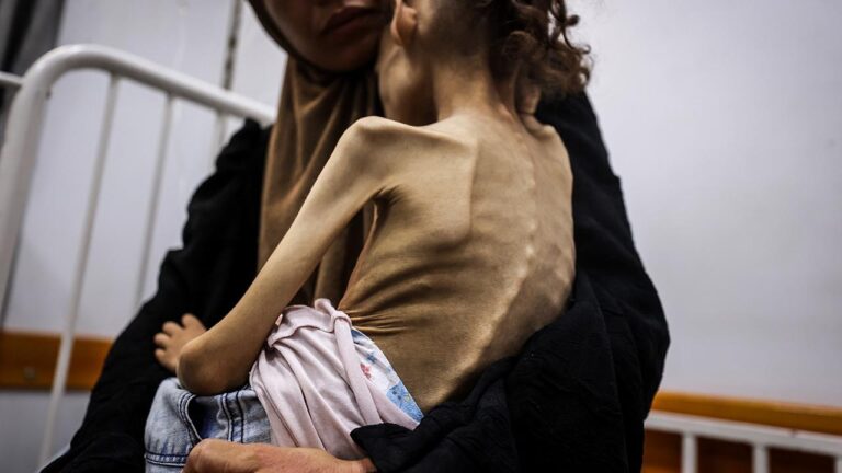 9 -Gazze'deki Mary Mary 25 kilodan 10 kilo düştü